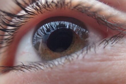 lentille UV